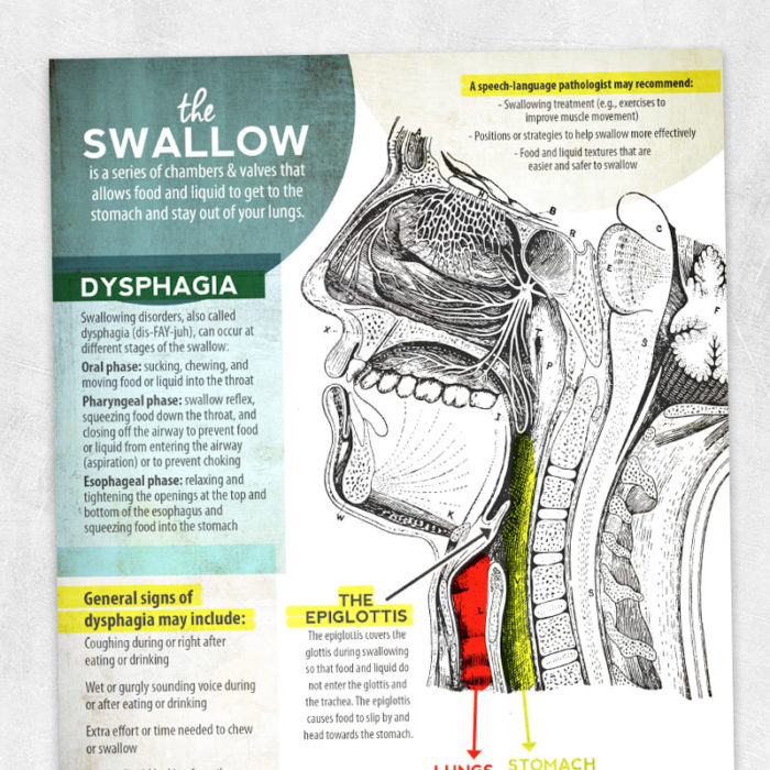 10 Dysphagia Resources that Promote Patient Choice – Therapy Insights