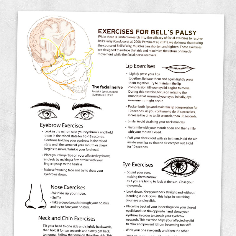 Eye treatment for Bell's palsy: A guide