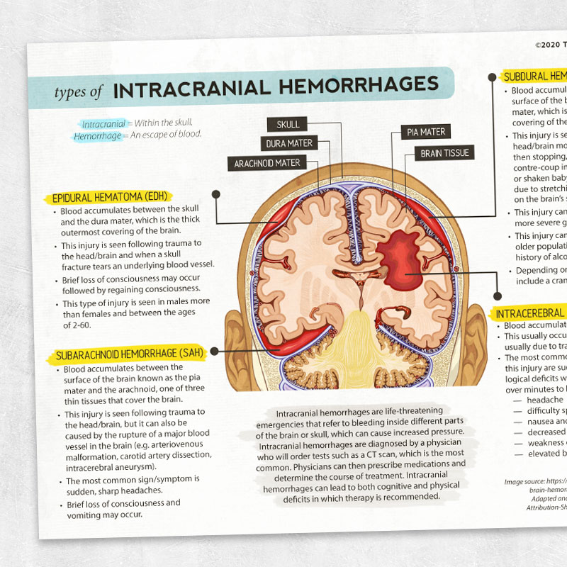 Intracranial Hemorrhages Adult And Pediatric Printable Resources For