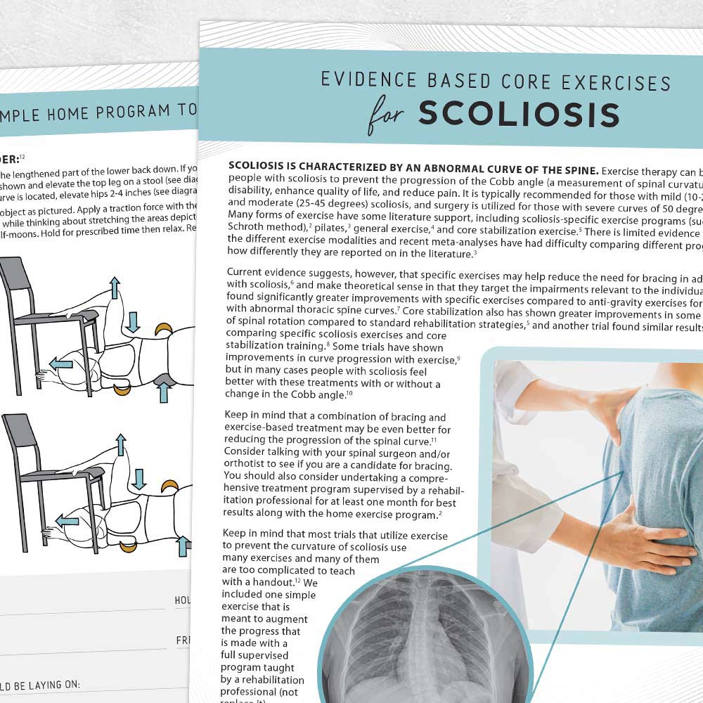 Physical therapy printable handout: Evidence based core exercises for scoliosis