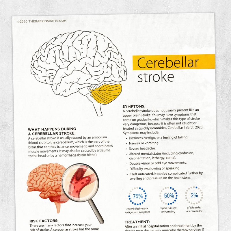 Speech, occupational, and physical therapy printable handout: Cerebellar stroke