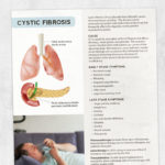 Physical therapy printable handout: Cystic Fibrosis