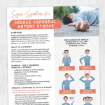 Physical and occupational therapy printable handout: Signs and symptoms of middle cerebral artery stroke