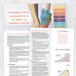 Physical therapy printable handout: Peripheral nerve entrapments of the tibial and peroneal nerves