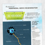 Physical therapy printable handout: Peripheral nerve regeneration