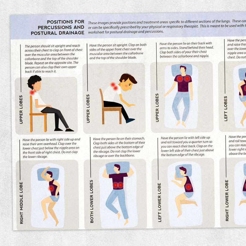 Physical therapy printable handout: Positions for percussions and postural drainage