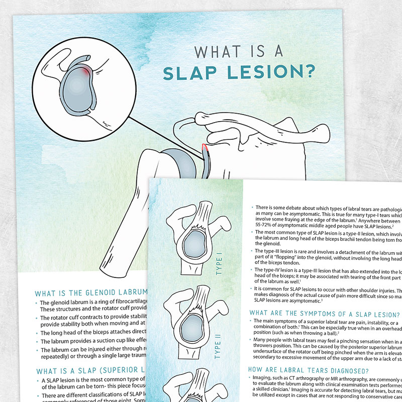 Physical therapy printable handout: What is a slap lesion?