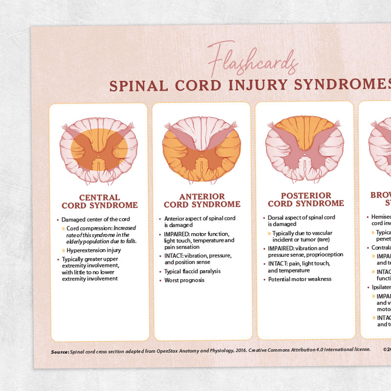Occupational therapy and physical therapy printable resource: Spinal cord injury syndromes