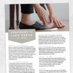 Occupational therapy printable handout: Strategies to limit edema at home