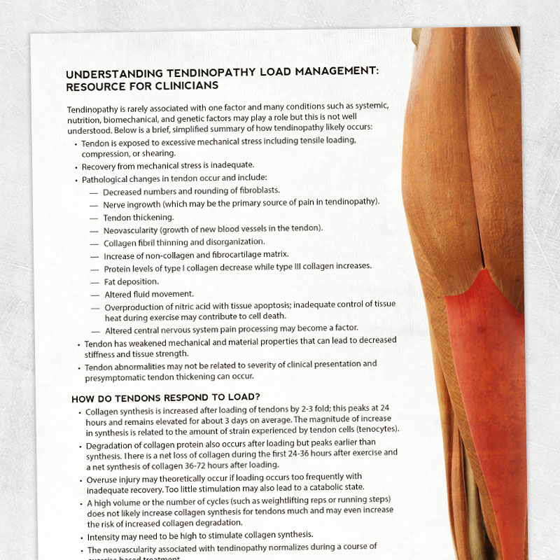 Physical therapy printable: Understanding tendinopathy load management
