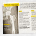OT and PT printable: Total hip arthroplasty