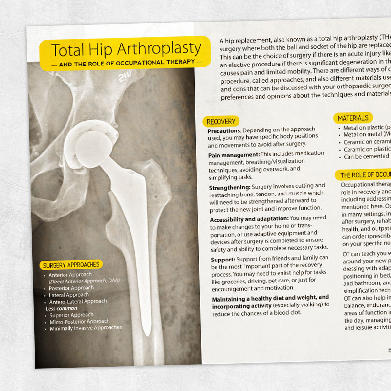 OT and PT printable: Total hip arthroplasty