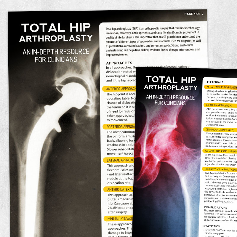 Physical and occupational therapy printable: Total hip arthroplasty