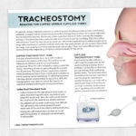 Med SLP printable handout: Tracheostomy