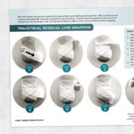 Physical therapy printable handout: Transtibial residual limb wrapping