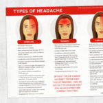 Physical therapy printable handout: Types of headache