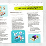 Physical and occupational therapy printable: Types of neuropathy