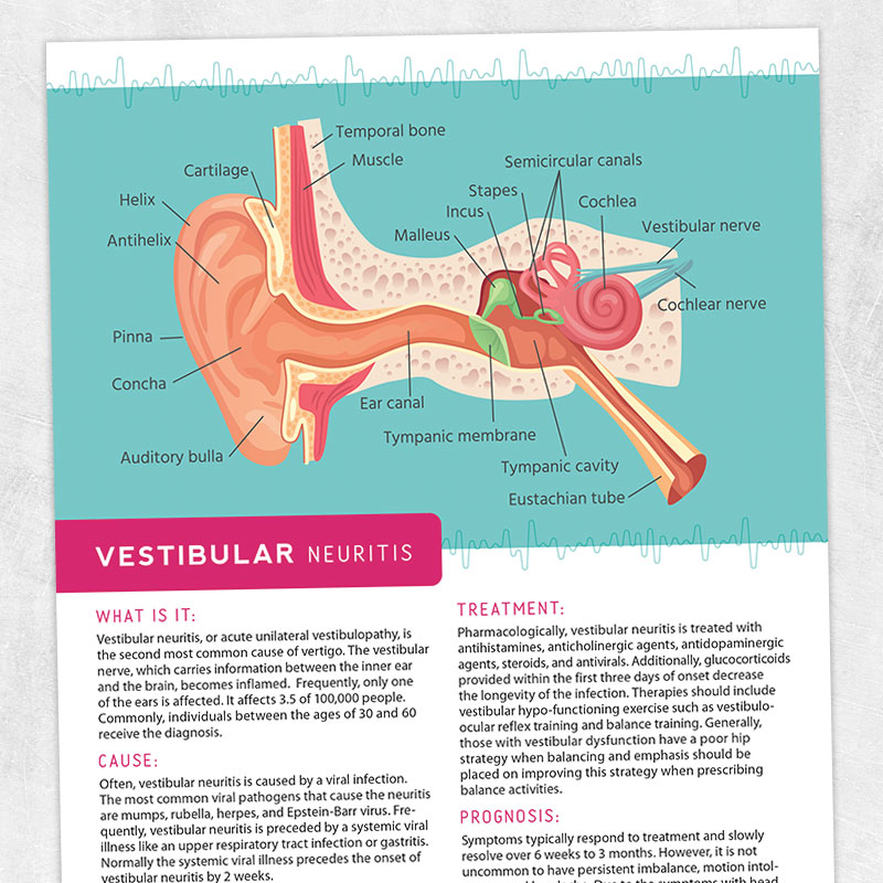 Physical therapy printable handout: Vestibular neuritis