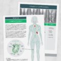 Occupational and physical therapy printable handout: What is lymphedema