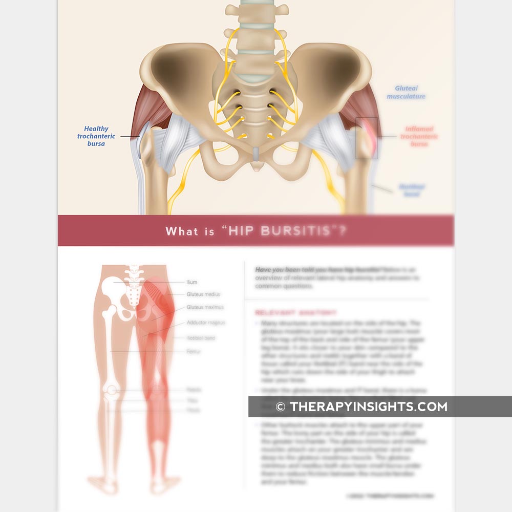 What Is Hip Bursitis?  BIM Sport & Spine Physical Therapy