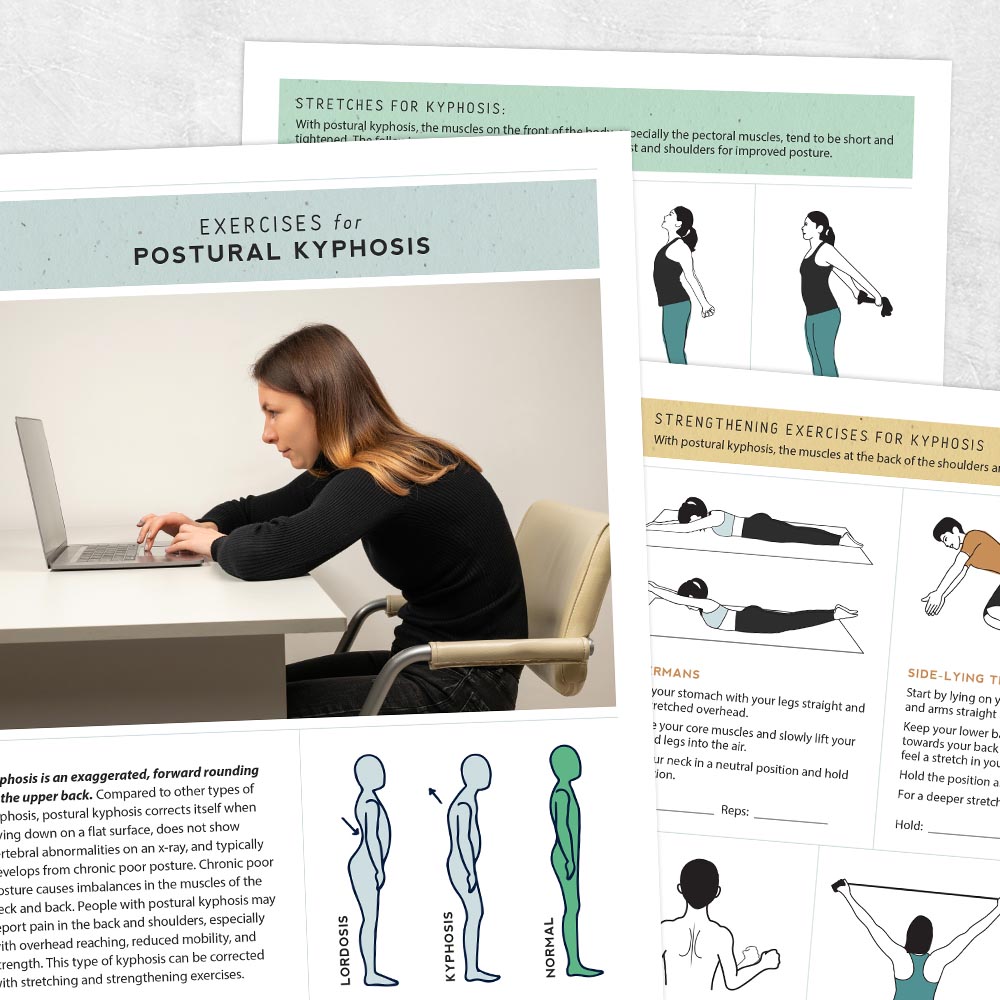 Exercises For Postural Kyphosis Printable Handouts For Speech 
