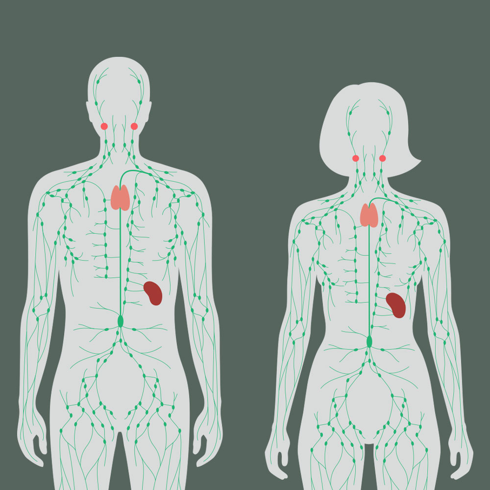 Introduction to Lymphedema – Continuing education for speech ...