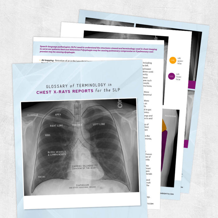 Dysphagia Archives Therapy Insights